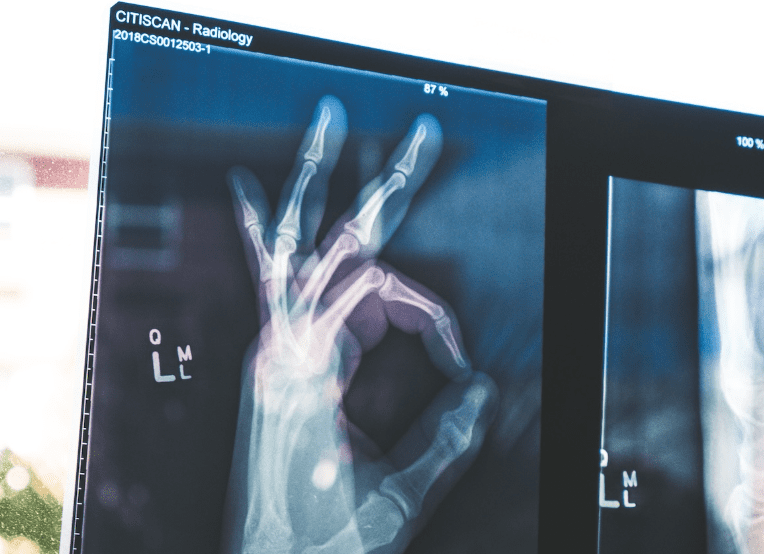 X-ray image of a hand putting up the "Ok" hand sign/hand gesture.