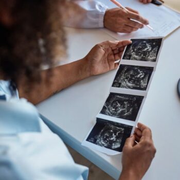 Over-the-shoulder shot of a woman looking at a sonogram image of a fetus.