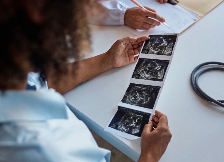 Over-the-shoulder shot of a woman looking at a sonogram image of a fetus.